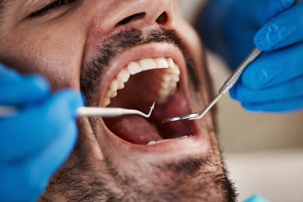 Best Emergency Gum Treatment in Northville, NY